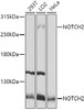 Western blot analysis of extracts of various cell lines, using NOTCH2 antibody (13-204) at 1:1000 dilution.<br/>Secondary antibody: HRP Goat Anti-Rabbit IgG (H+L) at 1:10000 dilution.<br/>Lysates/proteins: 25ug per lane.<br/>Blocking buffer: 3% nonfat dry milk in TBST.<br/>Detection: ECL Basic Kit.<br/>Exposure time: 5s.