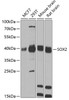 Western blot analysis of extracts of various cell lines, using SOX2 antibody (13-205) at 1:1000 dilution.<br/>Secondary antibody: HRP Goat Anti-Rabbit IgG (H+L) at 1:10000 dilution.<br/>Lysates/proteins: 25ug per lane.<br/>Blocking buffer: 3% nonfat dry milk in TBST.<br/>Detection: ECL Basic Kit.<br/>Exposure time: 90s.