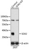 Western blot analysis of extracts from normal (control) and SOX2 knockout (KO) 293T cells, using SOX2 antibody (13-205) at 1:1000 dilution.<br/>Secondary antibody: HRP Goat Anti-Rabbit IgG (H+L) at 1:10000 dilution.<br/>Lysates/proteins: 25ug per lane.<br/>Blocking buffer: 3% nonfat dry milk in TBST.<br/>Detection: ECL Basic Kit.<br/>Exposure time: 1min.