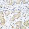 Immunohistochemistry of paraffin-embedded human stomach using EIF3A antibody (13-206) at dilution of 1:100 (40x lens) .