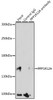 Immunoprecipitation analysis of 200ug extracts of HeLa cells, using 3 ug PPP1R12A antibody (13-210) . Western blot was performed from the immunoprecipitate using PPP1R12A antibody (13-210) at a dilition of 1:1000.