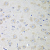 Immunohistochemistry of paraffin-embedded mouse brain using YES1 antibody (13-225) at dilution of 1:100 (40x lens) .