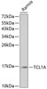 Western blot analysis of extracts of Ramos cells, using TCL1A antibody (13-226) at 1:1000 dilution.<br/>Secondary antibody: HRP Goat Anti-Rabbit IgG (H+L) at 1:10000 dilution.<br/>Lysates/proteins: 25ug per lane.<br/>Blocking buffer: 3% nonfat dry milk in TBST.