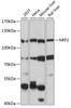 Western blot analysis of extracts of various cell lines, using NRF2 antibody (13-240) at 1:3000 dilution.<br/>Secondary antibody: HRP Goat Anti-Rabbit IgG (H+L) at 1:10000 dilution.<br/>Lysates/proteins: 25ug per lane.<br/>Blocking buffer: 3% nonfat dry milk in TBST.<br/>Detection: ECL Basic Kit.<br/>Exposure time: 60s.