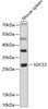 Western blot analysis of extracts of mouse spleen, using SOCS3 antibody (13-252) at 1:3000 dilution.<br/>Secondary antibody: HRP Goat Anti-Rabbit IgG (H+L) at 1:10000 dilution.<br/>Lysates/proteins: 25ug per lane.<br/>Blocking buffer: 3% nonfat dry milk in TBST.<br/>Detection: ECL Basic Kit.<br/>Exposure time: 30s.