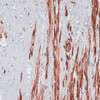 Immunohistochemistry of paraffin-embedded human appendix using DES antibody (13-255) at dilution of 1:100 (40x lens) .