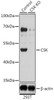 Western blot analysis of extracts from normal (control) and CSK knockout (KO) 293T cells, using CSK antibody (13-267) at 1:1000 dilution.<br/>Secondary antibody: HRP Goat Anti-Rabbit IgG (H+L) at 1:10000 dilution.<br/>Lysates/proteins: 25ug per lane.<br/>Blocking buffer: 3% nonfat dry milk in TBST.<br/>Detection: ECL Basic Kit.<br/>Exposure time: 1s.