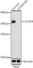 Western blot analysis of extracts from normal (control) and CCND3 knockout (KO) HeLa cells, using CCND3 antibody (13-271) at 1:1000 dilution.<br/>Secondary antibody: HRP Goat Anti-Rabbit IgG (H+L) at 1:10000 dilution.<br/>Lysates/proteins: 25ug per lane.<br/>Blocking buffer: 3% nonfat dry milk in TBST.<br/>Detection: ECL Basic Kit.<br/>Exposure time: 90s.