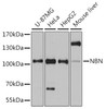 Western blot analysis of extracts of various cell lines, using NBN antibody (13-281) at 1:1000 dilution.<br/>Secondary antibody: HRP Goat Anti-Rabbit IgG (H+L) at 1:10000 dilution.<br/>Lysates/proteins: 25ug per lane.<br/>Blocking buffer: 3% nonfat dry milk in TBST.<br/>Detection: ECL Basic Kit.<br/>Exposure time: 90s.