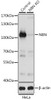 Western blot analysis of extracts from normal (control) and NBN knockout (KO) HeLa cells, using NBN antibody (13-281) at 1:1000 dilution.<br/>Secondary antibody: HRP Goat Anti-Rabbit IgG (H+L) at 1:10000 dilution.<br/>Lysates/proteins: 25ug per lane.<br/>Blocking buffer: 3% nonfat dry milk in TBST.<br/>Detection: ECL Basic Kit.<br/>Exposure time: 1s.