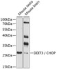 Western blot analysis of extracts of various cell lines, using DDIT3 / CHOP antibody (13-303) at 1:1000 dilution.<br/>Secondary antibody: HRP Goat Anti-Rabbit IgG (H+L) at 1:10000 dilution.<br/>Lysates/proteins: 25ug per lane.<br/>Blocking buffer: 3% nonfat dry milk in TBST.<br/>Detection: ECL Enhanced Kit.<br/>Exposure time: 20s.