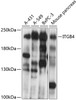 Western blot analysis of extracts of various cell lines, using ITGB4 antibody (13-306) at 1:1000 dilution.<br/>Secondary antibody: HRP Goat Anti-Rabbit IgG (H+L) at 1:10000 dilution.<br/>Lysates/proteins: 25ug per lane.<br/>Blocking buffer: 3% nonfat dry milk in TBST.<br/>Detection: ECL Basic Kit.<br/>Exposure time: 10s.