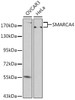 Western blot analysis of extracts of various cell lines, using SMARCA4 antibody (13-315) at 1:500 dilution.<br/>Secondary antibody: HRP Goat Anti-Rabbit IgG (H+L) at 1:10000 dilution.<br/>Lysates/proteins: 25ug per lane.<br/>Blocking buffer: 3% nonfat dry milk in TBST.