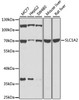 Western blot analysis of extracts of various cell lines, using SLC1A2 antibody (13-320) at 1:1000 dilution.<br/>Secondary antibody: HRP Goat Anti-Rabbit IgG (H+L) at 1:10000 dilution.<br/>Lysates/proteins: 25ug per lane.<br/>Blocking buffer: 3% nonfat dry milk in TBST.<br/>Detection: ECL Basic Kit.<br/>Exposure time: 15s.
