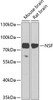 Western blot analysis of extracts of various cell lines, using NSF antibody (13-323) at 1:1000 dilution.<br/>Secondary antibody: HRP Goat Anti-Rabbit IgG (H+L) at 1:10000 dilution.<br/>Lysates/proteins: 25ug per lane.<br/>Blocking buffer: 3% nonfat dry milk in TBST.<br/>Detection: ECL Basic Kit.<br/>Exposure time: 15s.