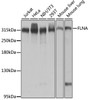 Western blot analysis of extracts of various cell lines, using FLNA antibody (13-324) at 1:1000 dilution.<br/>Secondary antibody: HRP Goat Anti-Rabbit IgG (H+L) at 1:10000 dilution.<br/>Lysates/proteins: 25ug per lane.<br/>Blocking buffer: 3% nonfat dry milk in TBST.<br/>Detection: ECL Basic Kit.<br/>Exposure time: 1s.