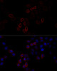 Immunofluorescence analysis of HeLa cells using FLNA antibody (13-324) at dilution of 1:100 (40x lens) . Blue: DAPI for nuclear staining.