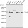 Western blot analysis of extracts of various cell lines, using TRAF2 antibody (13-338) at 1:1000 dilution.<br/>Secondary antibody: HRP Goat Anti-Rabbit IgG (H+L) at 1:10000 dilution.<br/>Lysates/proteins: 25ug per lane.<br/>Blocking buffer: 3% nonfat dry milk in TBST.
