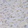 Immunohistochemistry of paraffin-embedded rat brain using GAD2 Antibody (13-343) at dilution of 1:100 (40x lens) .