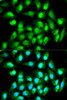 Immunofluorescence analysis of HeLa cells using RAN antibody (13-347) . Blue: DAPI for nuclear staining.