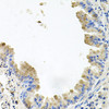 Immunohistochemistry of paraffin-embedded mouse lung using PI3 Kinase p110 beta antibody (13-351) at dilution of 1:100 (40x lens) .