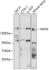 Western blot analysis of extracts of various cell lines, using MSH6 antibody (13-352) at 1:500 dilution.<br/>Secondary antibody: HRP Goat Anti-Rabbit IgG (H+L) at 1:10000 dilution.<br/>Lysates/proteins: 25ug per lane.<br/>Blocking buffer: 3% nonfat dry milk in TBST.