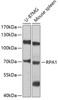 Western blot analysis of extracts of various cell lines, using RPA1 antibody (13-357) at 1:1000 dilution.<br/>Secondary antibody: HRP Goat Anti-Rabbit IgG (H+L) at 1:10000 dilution.<br/>Lysates/proteins: 25ug per lane.<br/>Blocking buffer: 3% nonfat dry milk in TBST.<br/>Detection: ECL Basic Kit.<br/>Exposure time: 1s.