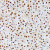 Immunohistochemistry of paraffin-embedded rat ovary using ID2 antibody (13-362) at dilution of 1:100 (40x lens) .