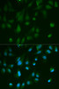 Immunofluorescence analysis of HeLa cells using ARRB1 antibody (13-363) . Blue: DAPI for nuclear staining.