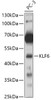 Western blot analysis of extracts of PC-3 cells, using KLF6 antibody (13-372) at 1:500 dilution.<br/>Secondary antibody: HRP Goat Anti-Rabbit IgG (H+L) at 1:10000 dilution.<br/>Lysates/proteins: 25ug per lane.<br/>Blocking buffer: 3% nonfat dry milk in TBST.<br/>Detection: ECL Basic Kit.<br/>Exposure time: 60s.