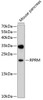 Western blot analysis of extracts of mouse pancreas, using RPRM antibody (13-374) at 1:1000 dilution.<br/>Secondary antibody: HRP Goat Anti-Rabbit IgG (H+L) at 1:10000 dilution.<br/>Lysates/proteins: 25ug per lane.<br/>Blocking buffer: 3% nonfat dry milk in TBST.<br/>Detection: ECL Basic Kit.<br/>Exposure time: 30s.