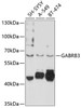 Western blot analysis of extracts of various cell lines, using GABRB3 antibody (13-375) at 1:1000 dilution.<br/>Secondary antibody: HRP Goat Anti-Rabbit IgG (H+L) at 1:10000 dilution.<br/>Lysates/proteins: 25ug per lane.<br/>Blocking buffer: 3% nonfat dry milk in TBST.<br/>Detection: ECL Basic Kit.<br/>Exposure time: 60s.