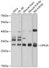 Western blot analysis of extracts of various cell lines, using UPK3A antibody (13-388) at 1:1000 dilution.<br/>Secondary antibody: HRP Goat Anti-Rabbit IgG (H+L) at 1:10000 dilution.<br/>Lysates/proteins: 25ug per lane.<br/>Blocking buffer: 3% nonfat dry milk in TBST.<br/>Detection: ECL Basic Kit.<br/>Exposure time: 5s.