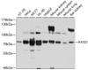Western blot analysis of extracts of various cell lines, using PATZ1 antibody (13-398) at 1:1000 dilution.<br/>Secondary antibody: HRP Goat Anti-Rabbit IgG (H+L) at 1:10000 dilution.<br/>Lysates/proteins: 25ug per lane.<br/>Blocking buffer: 3% nonfat dry milk in TBST.<br/>Detection: ECL Basic Kit.<br/>Exposure time: 15s.