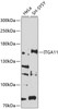 Western blot analysis of extracts of various cell lines, using ITGA11 antibody (13-420) at 1:1000 dilution.<br/>Secondary antibody: HRP Goat Anti-Rabbit IgG (H+L) at 1:10000 dilution.<br/>Lysates/proteins: 25ug per lane.<br/>Blocking buffer: 3% nonfat dry milk in TBST.<br/>Detection: ECL Basic Kit.<br/>Exposure time: 90s.