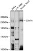 Western blot analysis of extracts of various cell lines, using SCN7A antibody (13-423) at 1:1000 dilution.<br/>Secondary antibody: HRP Goat Anti-Rabbit IgG (H+L) at 1:10000 dilution.<br/>Lysates/proteins: 25ug per lane.<br/>Blocking buffer: 3% nonfat dry milk in TBST.<br/>Detection: ECL Basic Kit.<br/>Exposure time: 10s.