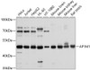 Western blot analysis of extracts of various cell lines, using AP1M1 antibody (13-446) at 1:1000 dilution.<br/>Secondary antibody: HRP Goat Anti-Rabbit IgG (H+L) at 1:10000 dilution.<br/>Lysates/proteins: 25ug per lane.<br/>Blocking buffer: 3% nonfat dry milk in TBST.<br/>Detection: ECL Basic Kit.<br/>Exposure time: 30s.