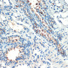 Immunohistochemistry of paraffin-embedded mouse lung using RPS6KA4 antibody (13-447) at dilution of 1:200 (40x lens) .