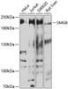 Western blot analysis of extracts of various cell lines, using SMG6 antibody (13-455) at 1:1000 dilution.<br/>Secondary antibody: HRP Goat Anti-Rabbit IgG (H+L) at 1:10000 dilution.<br/>Lysates/proteins: 25ug per lane.<br/>Blocking buffer: 3% nonfat dry milk in TBST.<br/>Detection: ECL Basic Kit.<br/>Exposure time: 30s.