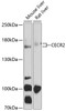 Western blot analysis of extracts of various cell lines, using CECR2 antibody (13-457) at 1:1000 dilution._Secondary antibody: HRP Goat Anti-Rabbit IgG (H+L) at 1:10000 dilution._Lysates/proteins: 25ug per lane._Blocking buffer: 3% nonfat dry milk in TBST._Detection: ECL Enhanced Kit._Exposure time: 60s.
