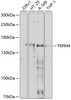 Western blot analysis of extracts of various cell lines, using TRPM4 antibody (13-460) at 1:1000 dilution.<br/>Secondary antibody: HRP Goat Anti-Rabbit IgG (H+L) at 1:10000 dilution.<br/>Lysates/proteins: 25ug per lane.<br/>Blocking buffer: 3% nonfat dry milk in TBST.<br/>Detection: ECL Basic Kit.<br/>Exposure time: 45s.