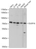 Western blot analysis of extracts of various cell lines, using DUSP16 antibody (13-468) at 1:1000 dilution.<br/>Secondary antibody: HRP Goat Anti-Rabbit IgG (H+L) at 1:10000 dilution.<br/>Lysates/proteins: 25ug per lane.<br/>Blocking buffer: 3% nonfat dry milk in TBST.<br/>Detection: ECL Basic Kit.<br/>Exposure time: 90s.