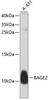 Western blot analysis of extracts of A-431 cells, using BAGE2 antibody (13-472) at 1:1000 dilution.<br/>Secondary antibody: HRP Goat Anti-Rabbit IgG (H+L) at 1:10000 dilution.<br/>Lysates/proteins: 25ug per lane.<br/>Blocking buffer: 3% nonfat dry milk in TBST.<br/>Detection: ECL Basic Kit.<br/>Exposure time: 90s.