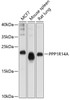 Western blot analysis of extracts of various cell lines, using PPP1R14A antibody (13-473) at 1:1000 dilution.<br/>Secondary antibody: HRP Goat Anti-Rabbit IgG (H+L) at 1:10000 dilution.<br/>Lysates/proteins: 25ug per lane.<br/>Blocking buffer: 3% nonfat dry milk in TBST.<br/>Detection: ECL Enhanced Kit.<br/>Exposure time: 60s.