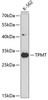 Western blot analysis of extracts of K562 cells, using TPMT antibody (13-480) at 1:1000 dilution.<br/>Secondary antibody: HRP Goat Anti-Rabbit IgG (H+L) at 1:10000 dilution.<br/>Lysates/proteins: 25ug per lane.<br/>Blocking buffer: 3% nonfat dry milk in TBST.