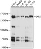 Western blot analysis of extracts of various cell lines, using IARS antibody (13-488) at 1:1000 dilution.<br/>Secondary antibody: HRP Goat Anti-Rabbit IgG (H+L) at 1:10000 dilution.<br/>Lysates/proteins: 25ug per lane.<br/>Blocking buffer: 3% nonfat dry milk in TBST.<br/>Detection: ECL Basic Kit.<br/>Exposure time: 1s.