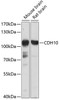 Western blot analysis of extracts of various cell lines, using CDH10 antibody (13-498) at 1:1000 dilution._Secondary antibody: HRP Goat Anti-Rabbit IgG (H+L) at 1:10000 dilution._Lysates/proteins: 25ug per lane._Blocking buffer: 3% nonfat dry milk in TBST._Detection: ECL Basic Kit._Exposure time: 10s.