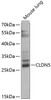 Western blot analysis of extracts of mouse lung, using CLDN5 antibody (13-500) at 1:1000 dilution.<br/>Secondary antibody: HRP Goat Anti-Rabbit IgG (H+L) at 1:10000 dilution.<br/>Lysates/proteins: 25ug per lane.<br/>Blocking buffer: 3% nonfat dry milk in TBST.<br/>Detection: ECL Enhanced Kit.<br/>Exposure time: 60s.