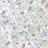 Immunohistochemistry of paraffin-embedded rat brain using SERPINA3 antibody (13-502) at dilution of 1:100 (40x lens) .