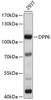 Western blot analysis of extracts of 293T cells, using DPP6 antibody (13-503) at 1:1000 dilution.<br/>Secondary antibody: HRP Goat Anti-Rabbit IgG (H+L) at 1:10000 dilution.<br/>Lysates/proteins: 25ug per lane.<br/>Blocking buffer: 3% nonfat dry milk in TBST.<br/>Detection: ECL Basic Kit.<br/>Exposure time: 10s.